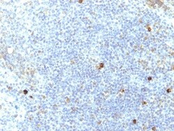 HLA A Antibody (SPM417), Novus Biologicals 0.2mg; Unlabeled:Antibodies,